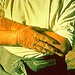 Hands damaged by kerosene, by National Institute for Occupational Safety and Health. The hands, wrists and forearms are the most frequent sites of involvement in cases of industrial contact dermatitis. The hands and wrists of this worker with a chronic dermatitis show the effect of long term exposure to a solvent, in this case kerosene.